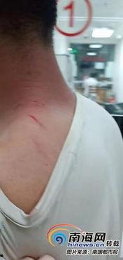 海口情侣吃瓜事件  第2张